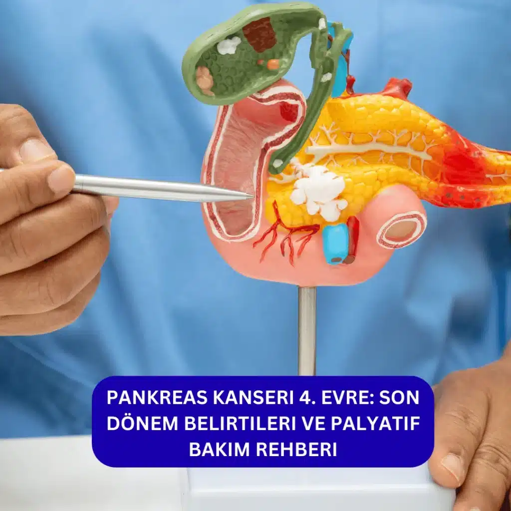 pankreas kanseri 4. evre belirtileri