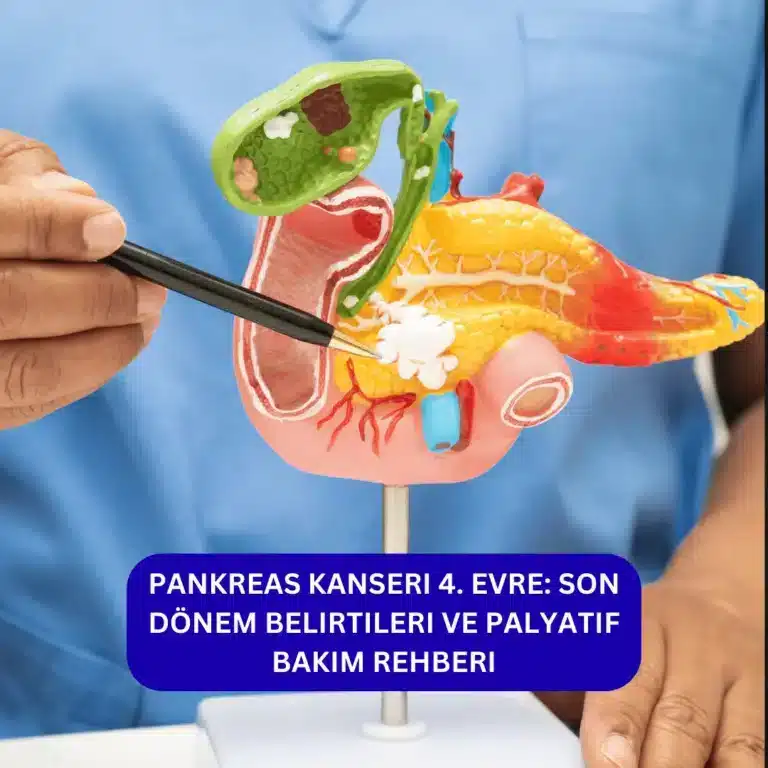 Pankreas Kanseri 4. Evre: Son Dönem Belirtileri ve Palyatif Bakım Rehberi pankreas kanseri 4. evre belirtileri neler