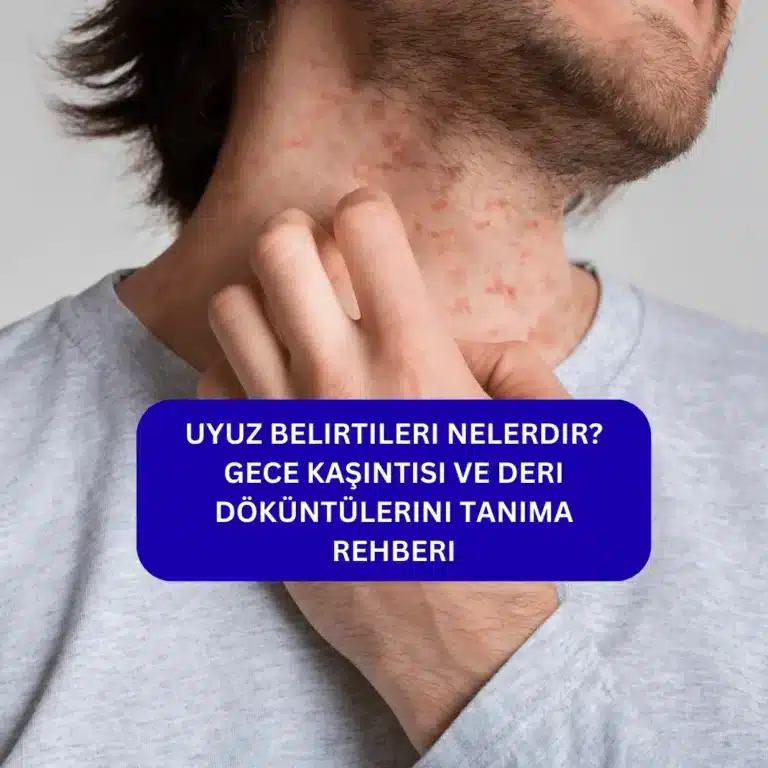Uyuz Belirtileri Nelerdir? Gece Kaşıntısı ve Deri Döküntülerini Tanıma Rehberi Uyuz Belirtileri Nelerdir? Gece Kaşıntısı ve Deri Döküntülerini Tanıma Rehberi neler
